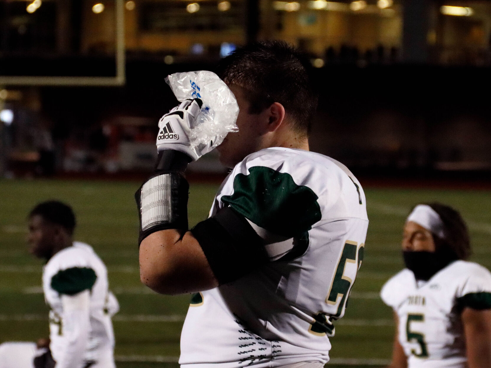 Fort Zumwalt North senior Brendan Mahoney ices his left eye